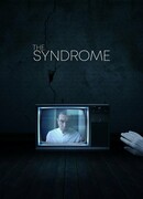 Синдром