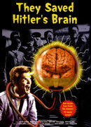 Они сохранили мозг Гитлера
