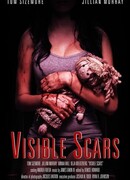 Видимые шрамы