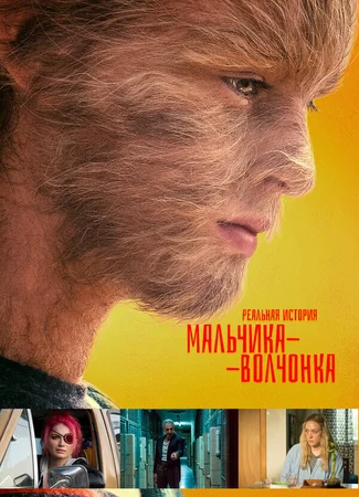 Реальная история мальчика-волчонка