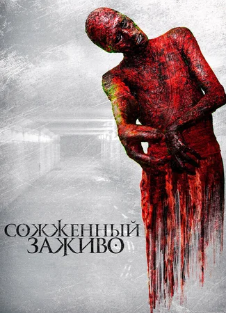 Сожженный заживо