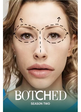 кино Изуродованные тела (Botched) 02.03.25